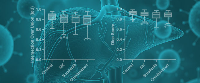 Multi-Task Deep Learning on MRI for Tumor Segmentation and Treatment Response Prediction in an Experimental Model of Hepatocellular Carcinoma
