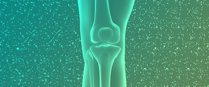 Severe OA Synovial Fluid EVs Promote Catabolic Chondrocyte Phenotype