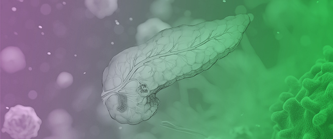 Proteomic Characterization of Primary Human Pancreatic Cancer Cell Lines Following Long-Term Exposure to Gemcitabine