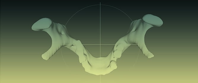 Classifying Sex from MSCT-Derived 3D Mandibular Models Using an Adapted PointNet++ Deep Learning Approach in a Croatian Population