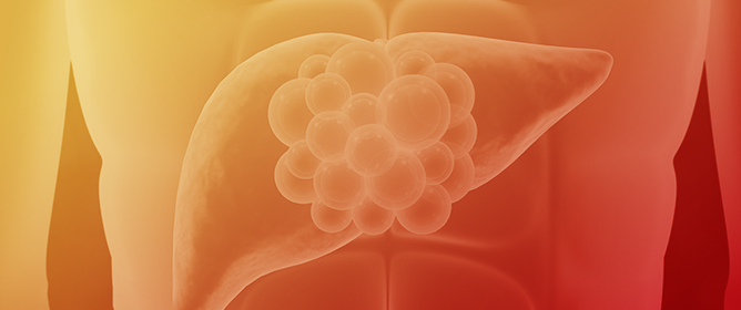 Metabolic-Associated Steatotic Liver Disease (MASLD) and Type 2 Diabetes: Mechanisms, Diagnostic Approaches, and Therapeutic Interventions