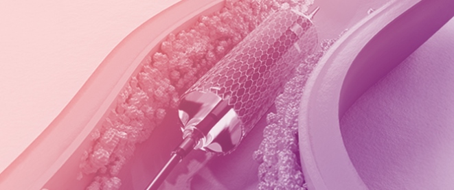 Bioresorbable Scaffolds for Coronary Revascularization: From Concept to Clinical Maturity