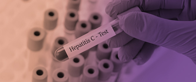 Peer-Delivered Hepatitis C Testing and Health Screening Provided in a Community Pharmacy Setting: Proof of Concept