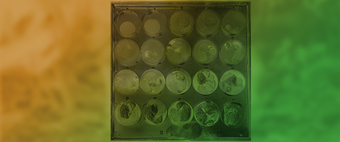 Functional Effects of Single-Stage vs. Multi-Stage Incubation Systems and Parental Flock Age on Embryonic Development, Oxidative Stress, and Performance of Male Broiler Chickens