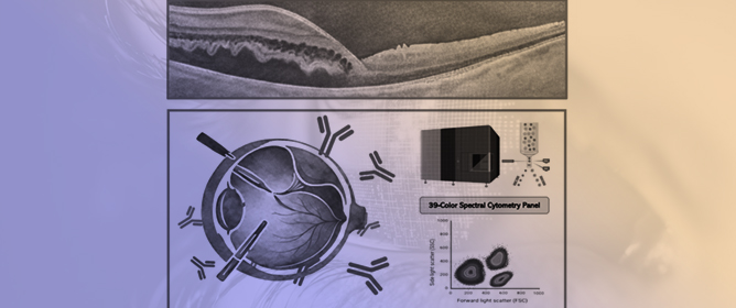 Immune Profiling of Retinal Detachment by Spectral Flow Cytometry