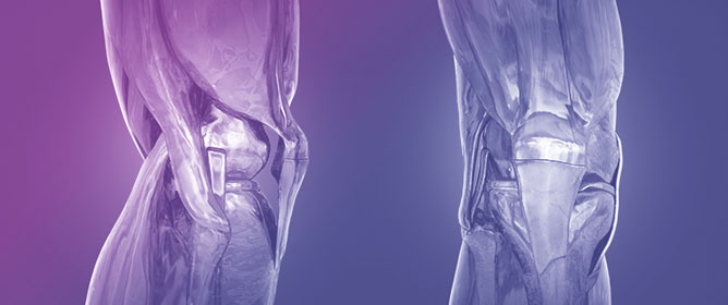 Quality of Online Information on Patient-Specific Knee Arthroplasty and Its Impact on Personalized Care