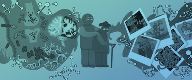 Polyoxometalates' Progress for the Treatment of Alzheimer&rsquo;s Disease