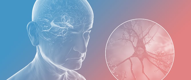From Fork to Brain: The Role of AGE&ndash;RAGE Signaling and the Western Diet in Neurodegenerative Disease