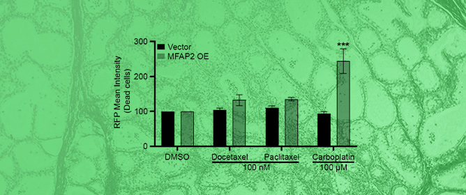 Evaluation of Metaplastic Triple-Negative Breast Cancer Extracellular Matrix Structure and Protein Composition