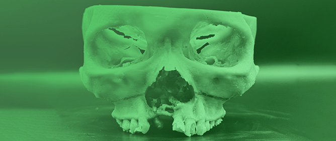 Synergistic Triad of Mixed Reality, 3D Printing, and Navigation in Complex Craniomaxillofacial Reconstruction