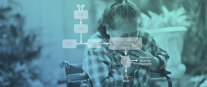 RASopathy and Sudden Cardiac Death: A Literature Review