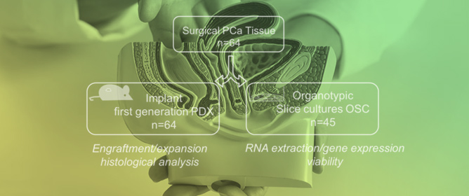 A Feasibility Study of Co-Established Patient-Derived Subcutaneous Xenograft and Organotypic Slice Cultures in Hormone-Naive Primary Prostate Cancer Preclinical Modeling: A Single-Institution Experience
