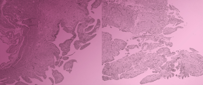 Clinical Presentation, Detection, and Immunopathogenesis of <em>Mycoplasma hyosynoviae</em> Field Isolates in Experimentally Inoculated Pigs