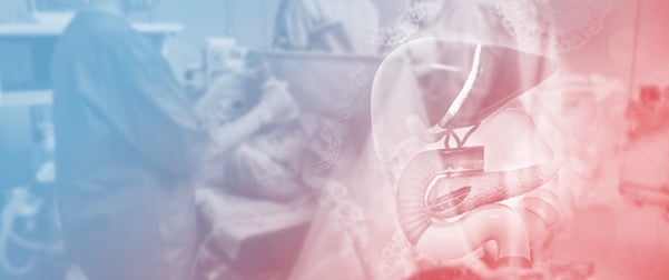 Early Graft Loss in Solitary Pancreas Transplant Recipients Within Eurotransplant Region