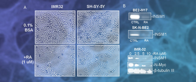 <em>INSM1</em> Expression and NE Differentiation in High-Risk NB