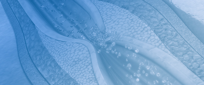 Early SGLT2 Inhibitor Therapy in Acute Coronary Syndrome: Mitigating Adverse Remodeling in High-Risk Phenotypes&mdash;A Real-World Study