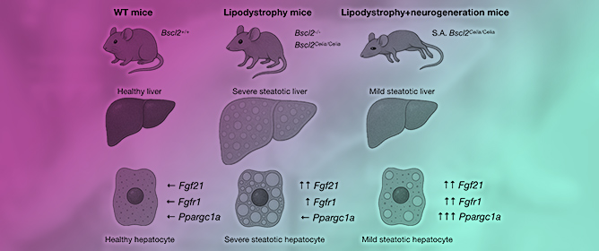 Metabolic-Associated Steatotic Liver Disease and FGF21 Dysregulation in Seipin-Deficient and BSCL2-Associated Celia&rsquo;s Encephalopathy Murine Models