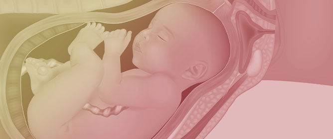 Double Versus Single Cervical Cerclage in Women with Cervical Insufficiency: A Systematic Review of Prophylactic and Emergency Indications