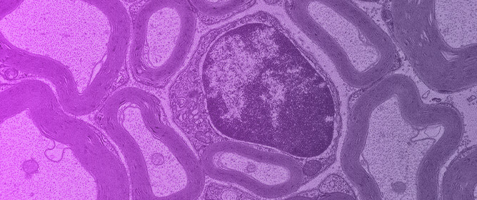 Hereditary Polyneuropathies in the Era of Precision Medicine: Genetic Complexity and Emerging Strategies