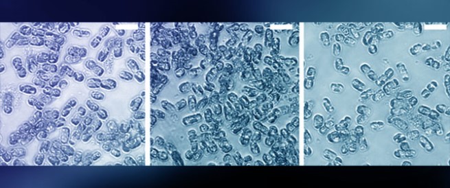 Investigating the Molecular Response of <em>Skeletonema marinoi</em> to Polyethylene Nano/Microplastics