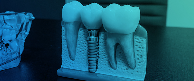 Titanium Alloys at the Interface of Electronics and Biomedicine: A Review of Functional Properties and Applications