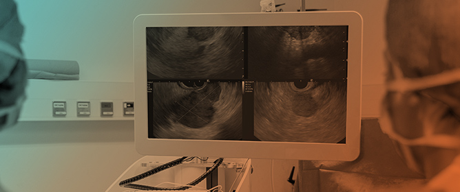 Role of Endoscopic Ultrasound in Pancreatic Metastases: A Comprehensive Review