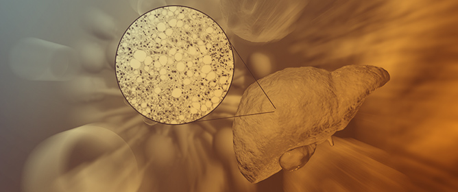 New Definition, New Point of View: Sex and Gender Interpretation of MASLD&mdash;Interpretation of Guidelines and Review of the Literature