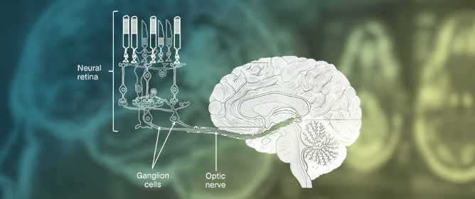 The Retina as a Window to Neurodegeneration: OCT Insights