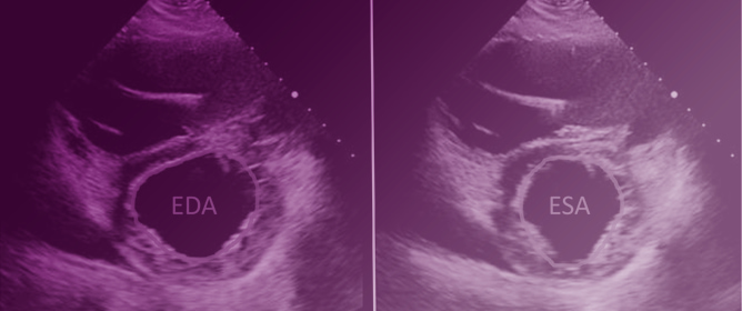 Routine Echocardiographic Assessment in LVAD Patients&mdash;A Structured Approach to Acquisition and Interpretation