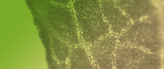 Regulation of Plasmodesmata Function Through Lipid-Mediated PDLP7 or PDLP5 Strategies in <em>Arabidopsis</em> Leaf Cells