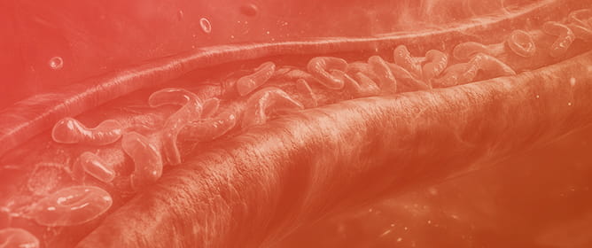 Early Vasoplegia and Endothelial Protection in Sepsis: Timing Albumin and Norepinephrine Therapy