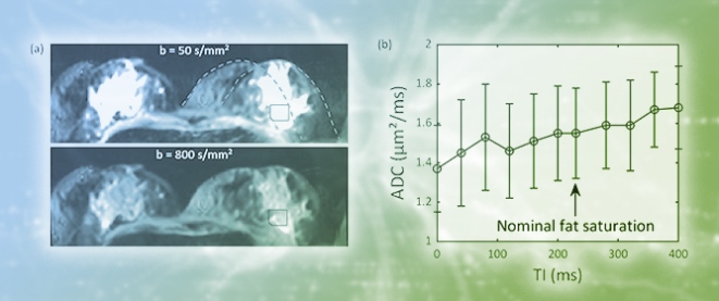 Overestimation of the Apparent Diffusion Coefficient in Diffusion-Weighted Imaging Due to Residual Fat Signal and Out-of-Phase Conditions