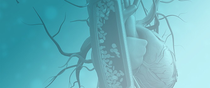 Management of Implantable Cardiovascular Devices in Patients Undergoing Radiotherapy