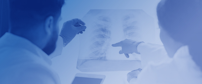 Most Promising Emerging Therapies for Pulmonary Fibrosis: Targeting Novel Pathways