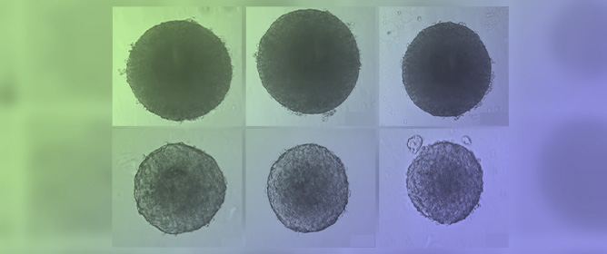 3D Endometrial Stromal and Trophoblast Spheroids: Optimized Formation and Cryopreservation