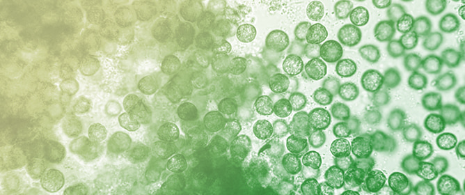 Breeding Chlorophyll-Deficient Mutants of <em>Chlorella vulgaris</em> to Enhance Consumer Acceptance
