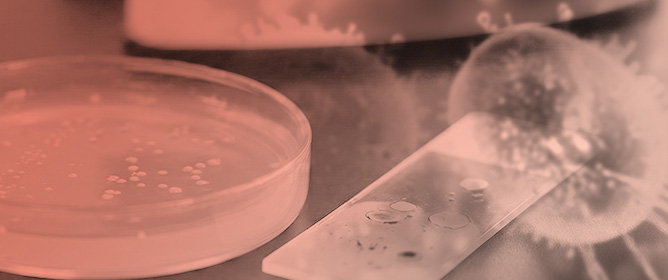 Methenamine as an Alternative Treatment of <em>Neisseria gonorrhoeae</em> Urethritis? An In Vitro and In Vivo Study in <em>Galleria mellonella</em>