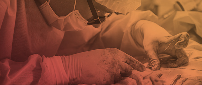 Topical TXA with Epinephrine for Perioperative Bleeding