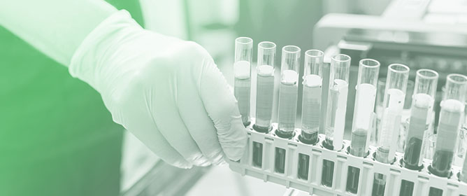 Biosensor Technologies for Avian Influenza Detection: A New Frontier in Rapid Diagnostics for HPAI