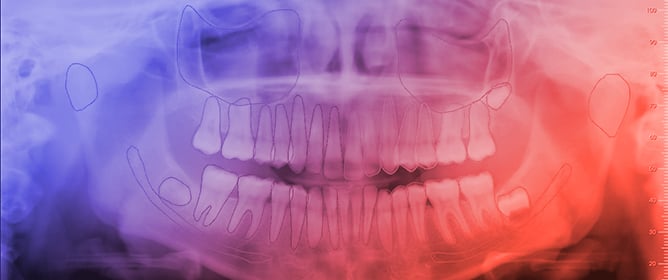 Performance Validation of ORTHOSEG, a Novel Artificial Intelligence Tool for the Segmentation of Orthopantomographs and Intra-Oral X-Rays