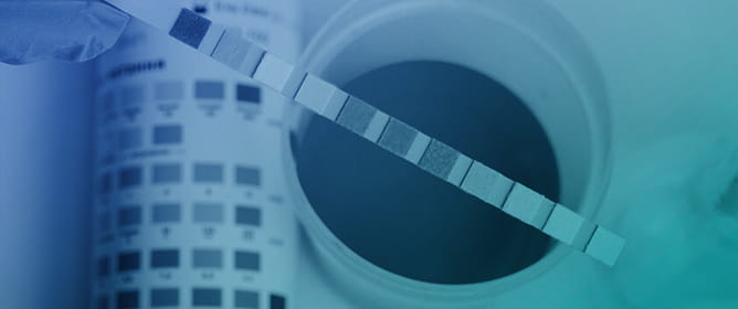 Investigation of Storage Conditions and Quality Control Markers for Metabolites and Lipids in Human Feces