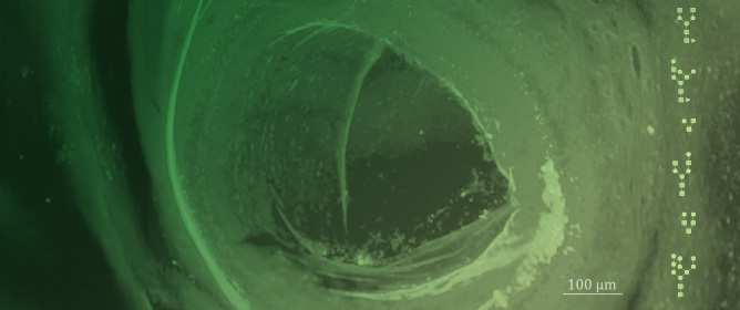 Deciphering the <em>Fasciola hepatica</em> Glycocode in Host&ndash;Parasite Interactions