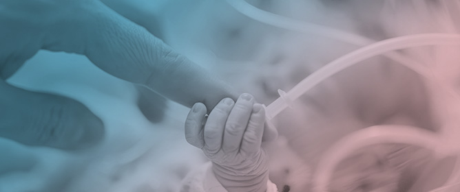 Non-Invasive Surfactant Administration in Preterm Infants