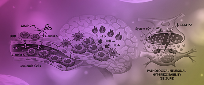 Molecular and Mechanistic Divergence of Seizures in Pediatric Acute Lymphoblastic Leukemia: CNS Infiltration Versus Chemotherapy-Induced Neurotoxicity