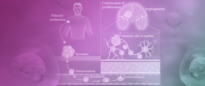 Unraveling the Enigma of Melanoma Brain Metastasis: New Molecular Insights and Therapeutic Directions