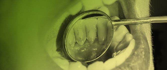The Oral Microbiome and Systemic Health: Current Insights into the Mouth&ndash;Body Connection