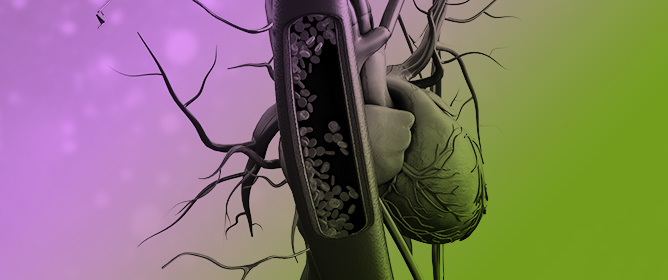 Assessment of Congestion in Heart Failure Using VExUS: Current Evidence, Limitations and Clinical Perspectives