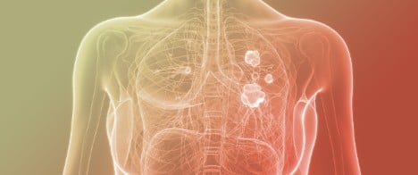 Vape-Associated lncRNA Transcript 1 (VALT1) Amplifies the Tumorigenic Effects of e-Cigarette Vapor in Lung Epithelial Cells