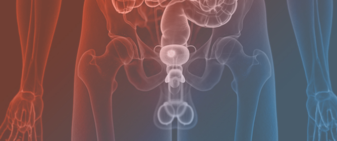 Updated Analysis: Blue-Light Transurethral Resection and Biopsy of Bladder Cancer with Hexaminolevulinate in a Single UK Centre