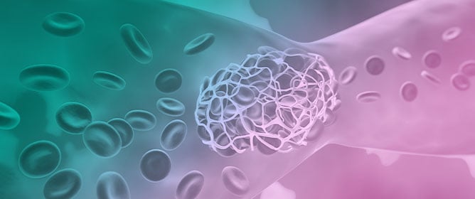 Navigating the Hemostatic Balance: Anticoagulation and Antiplatelet Therapy in Patients with Thrombocytopenia